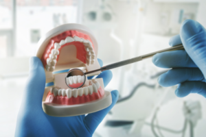 Fake teeth with good oral hygiene being checked by dentist with magnifying tool